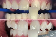 xr:d:DAF8nO9TgpQ:11,j:8051728721332797855,t:24021220