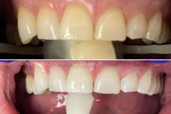 xr:d:DAF8nO9TgpQ:11,j:8051728721332797855,t:24021220