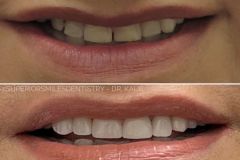 xr:d:DAF8nO9TgpQ:11,j:8051728721332797855,t:24021220