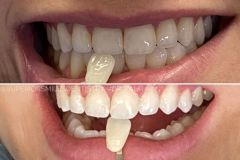 xr:d:DAF8nO9TgpQ:11,j:8051728721332797855,t:24021220