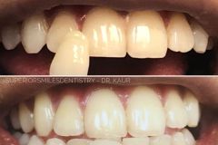 xr:d:DAF8nO9TgpQ:11,j:8051728721332797855,t:24021220