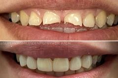 xr:d:DAF8nO9TgpQ:11,j:8051728721332797855,t:24021220