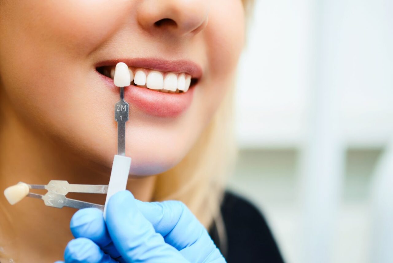 Superior Smiles Dentistry Cosmetic Dentist in Bakersfield, CA