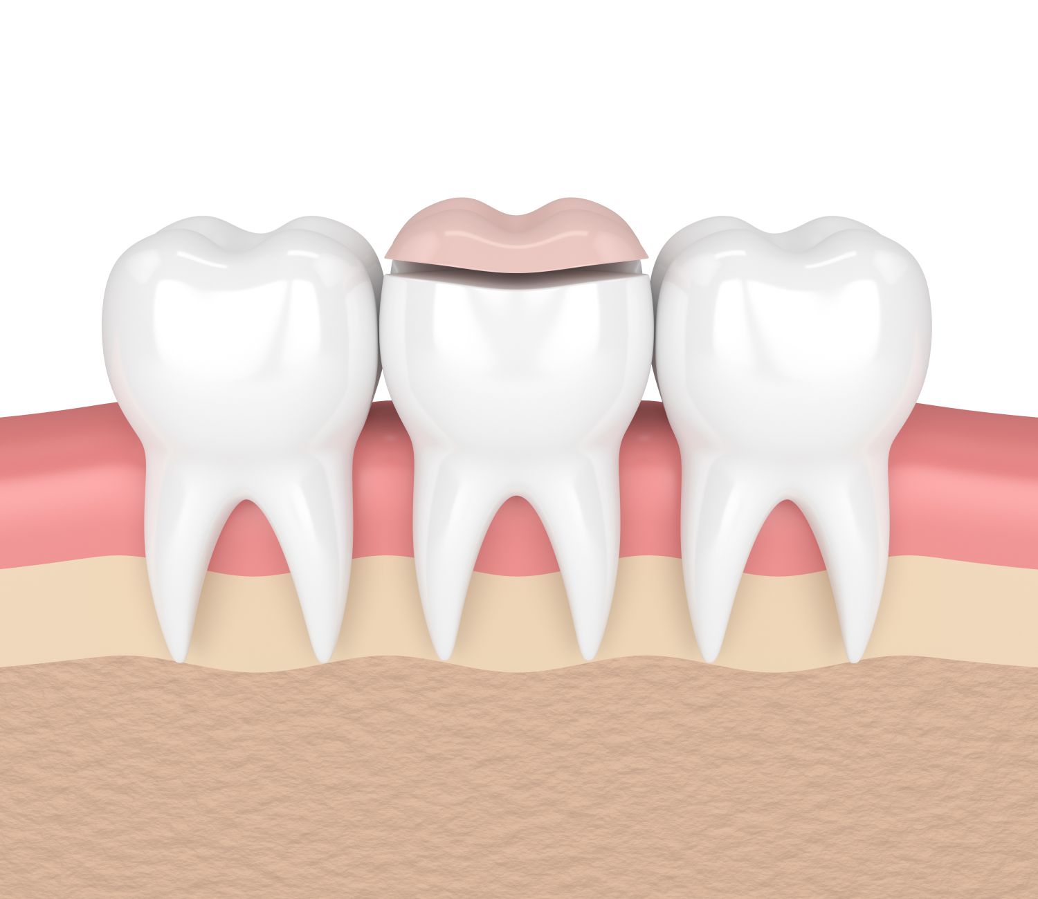 Superior Smiles Dentistry Bakersfield California