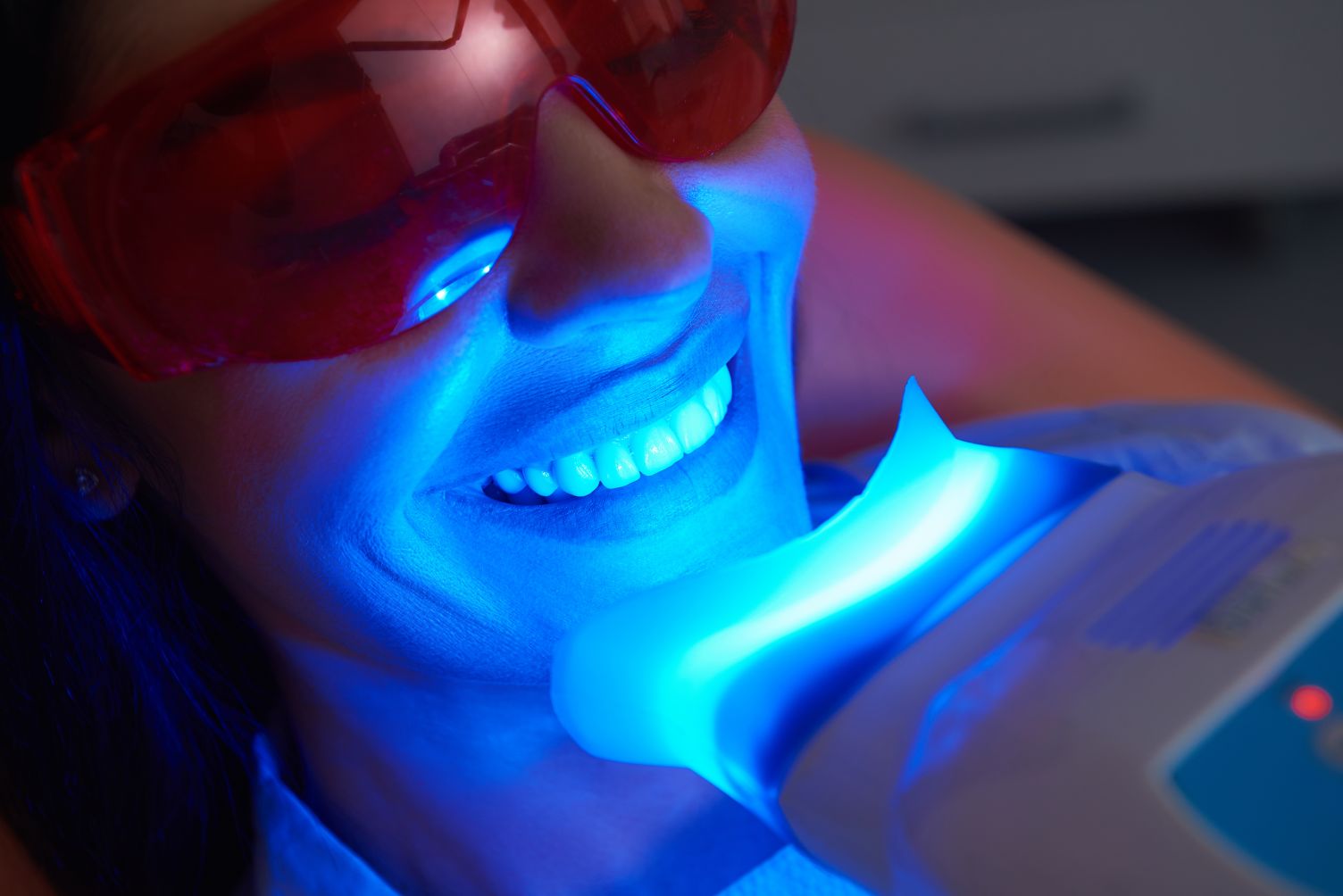 Can you use teeth whitening products on veneers