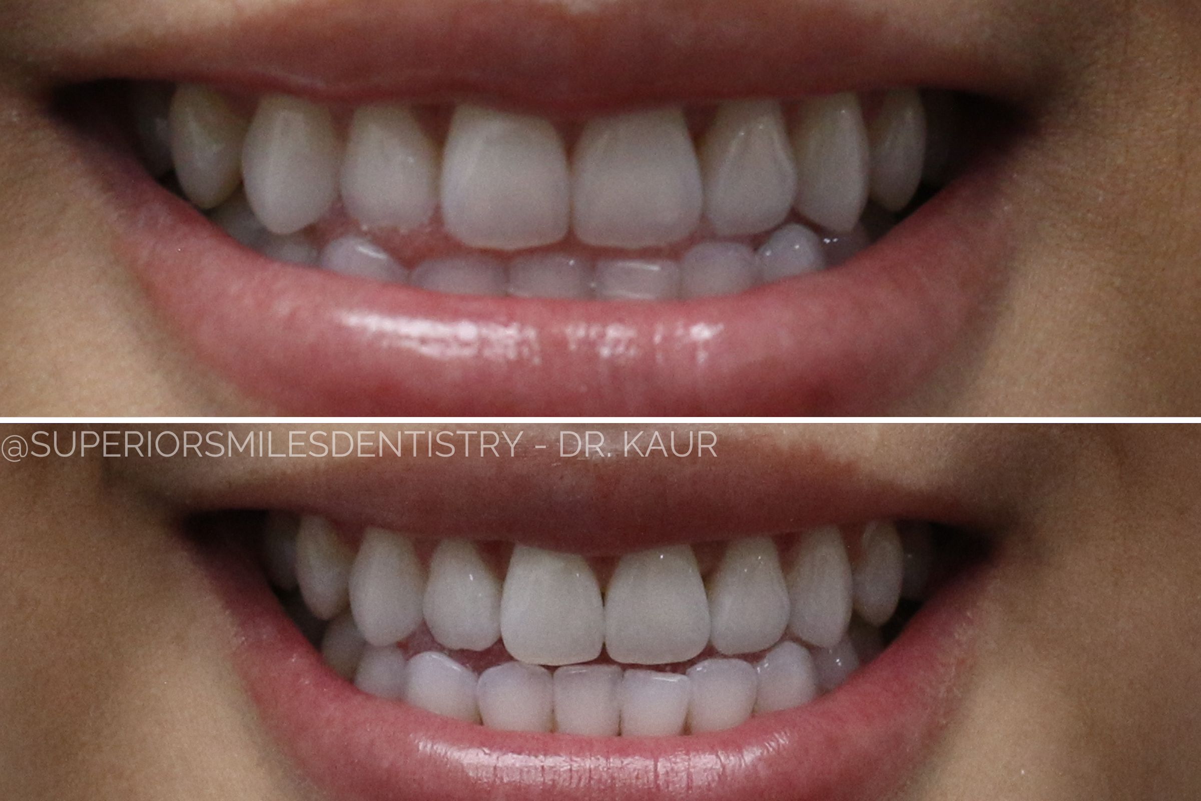 xr:d:DAF8nO9TgpQ:11,j:8051728721332797855,t:24021220