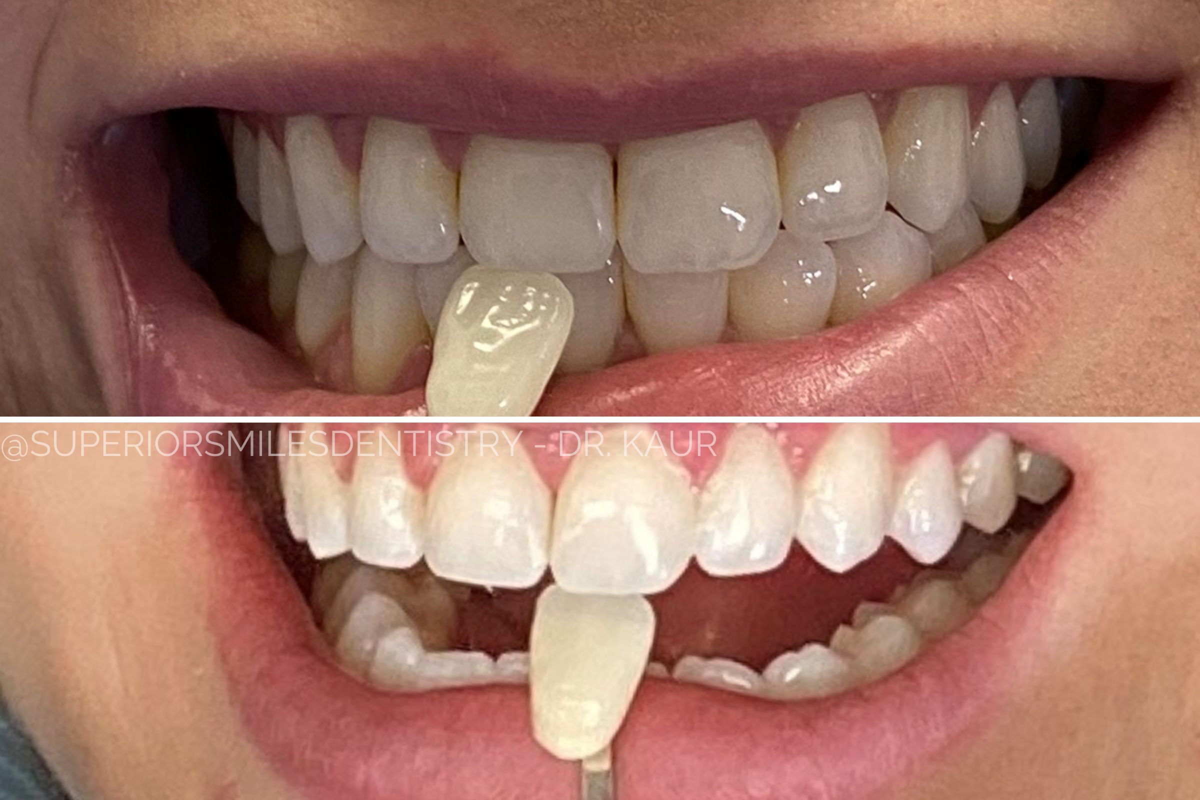 xr:d:DAF8nO9TgpQ:11,j:8051728721332797855,t:24021220