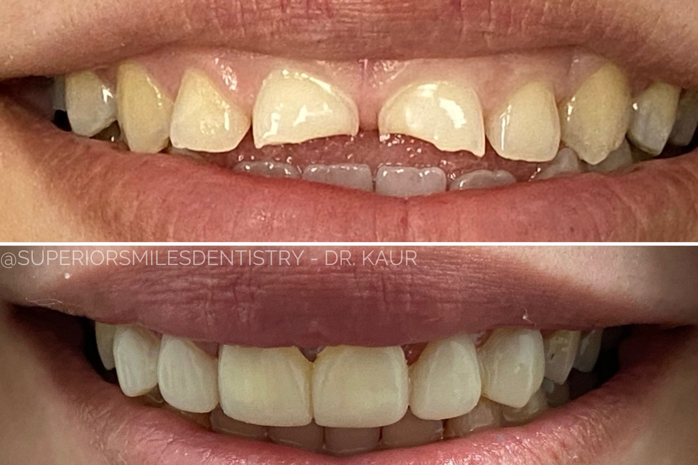 xr:d:DAF8nO9TgpQ:11,j:8051728721332797855,t:24021220