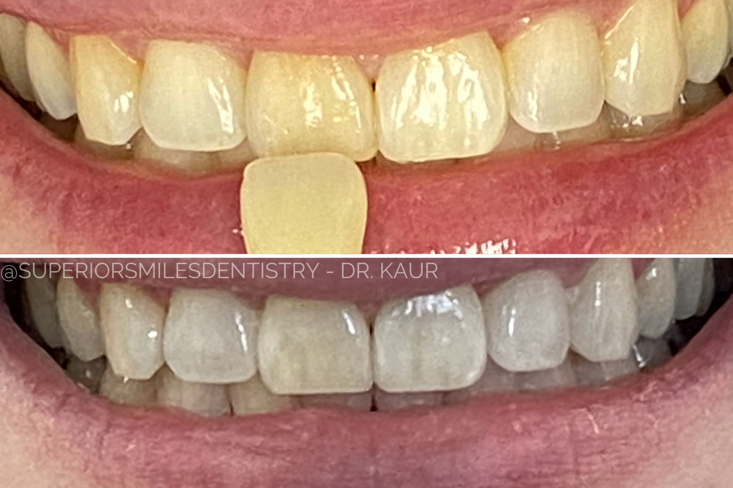 xr:d:DAF8nO9TgpQ:11,j:8051728721332797855,t:24021220